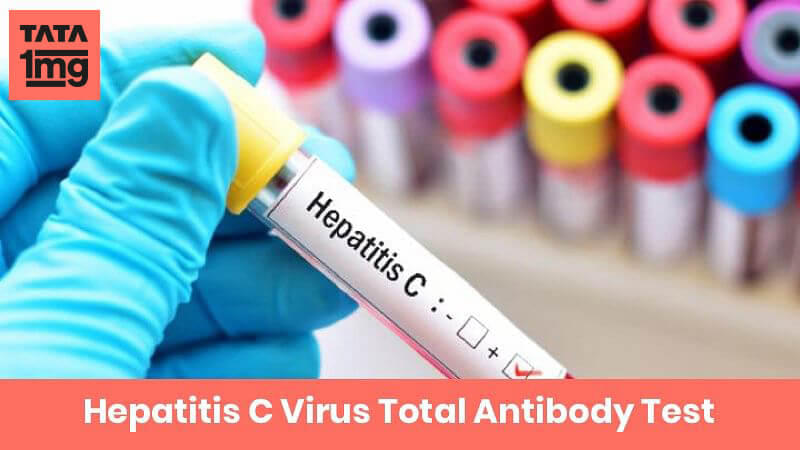 Hepatitis C Virus Total Antibody